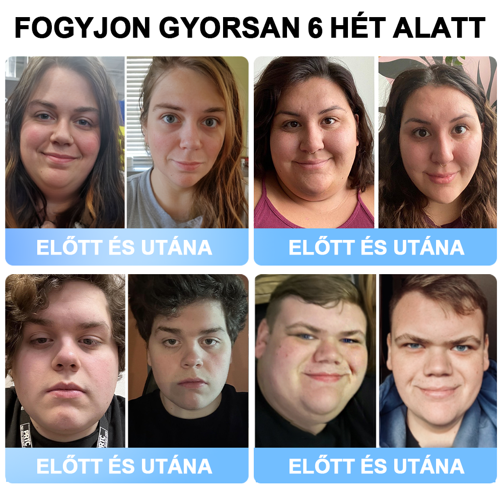 đFormaĂletÂź Nano MikrotƱ Tapasz SMGT-GLP-1-tel Ă©s Matrixyl 3000-rel â FogyĂĄs, BĆrfeszesĂtĂ©s, VĂ©rcukorszint-tĂĄmogatĂĄs, InjekciĂł NĂ©lkĂŒl, 7 Napos EredmĂ©ny