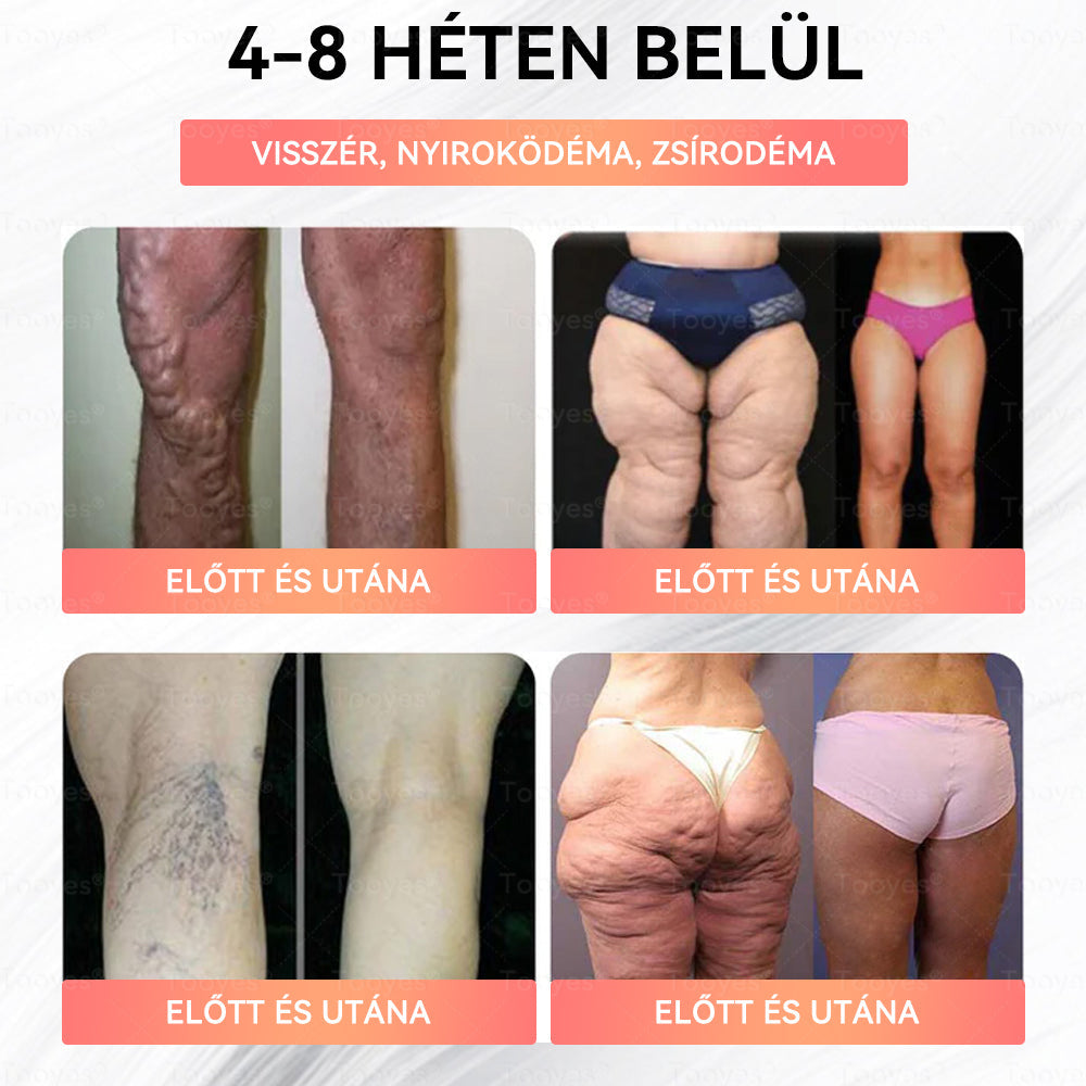 ✨Tooyes® GLP-1 Magas Koncentrációjú Folyékony Gyöngyök – NAD+, Moringa, HCA összetevőkkel (Fogyás, Öregedésgátlás, Bél- és Immunrendszer támogatás, Vércukorszint egyensúly, Szív- és Agyegészség) ⚡