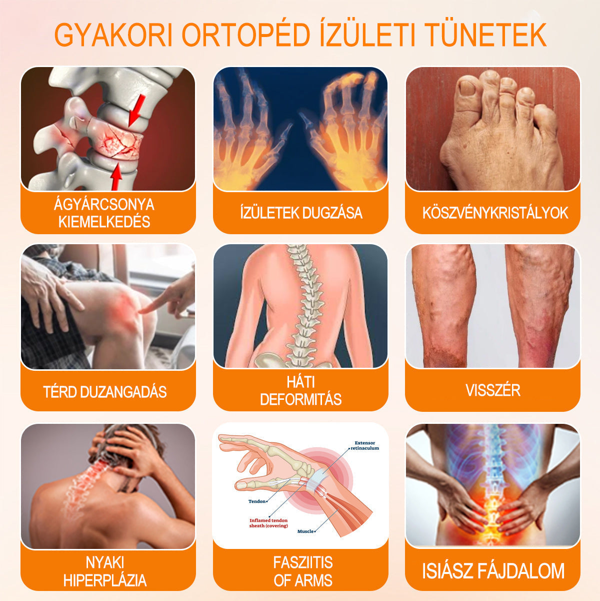 Gbpurity Méhméreg és Glükózamin Ízületi Krém – Hivatalos Márkabolt, MOT Jóváhagyással