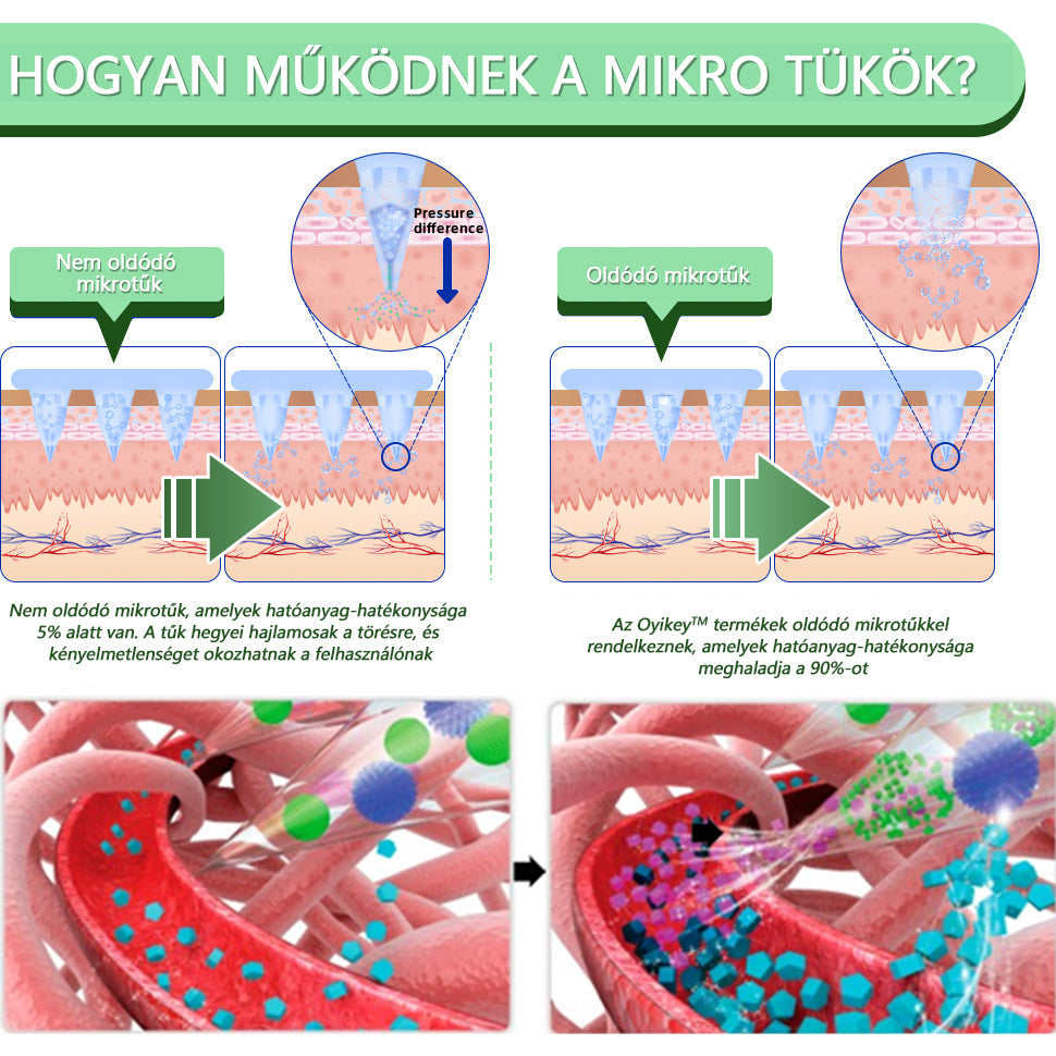 [Lásd az eredményeket 7 nap múlva]🌲Voilaist® SMGT-GLP-1 nano mikrotűs tapasz (Fájdalommentes, hosszan tartó, kezeli a cukorbetegséget, az elhízást és a szív- és érrendszeri betegségeket)