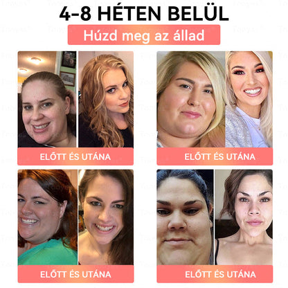 🎉Gratulálunk! Ma te lettél a szerencsés vásárlónk! Ez alkalomból extra 50% kedvezményt adunk neked! Ne szalaszd el ezt a lehetőséget – ha ma nem élsz vele, lehet, hogy csak jövőre lesz újra ilyen esélyed!🔥Tooyes®