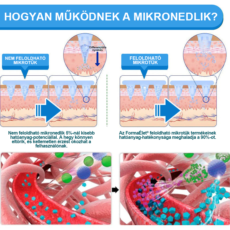 🏆FormaÉlet® Nano Mikrotű Tapasz SMGT-GLP-1-tel és Matrixyl 3000-rel – Fogyás, Bőrfeszesítés, Vércukorszint-támogatás, Injekció Nélkül, 7 Napos Eredmény