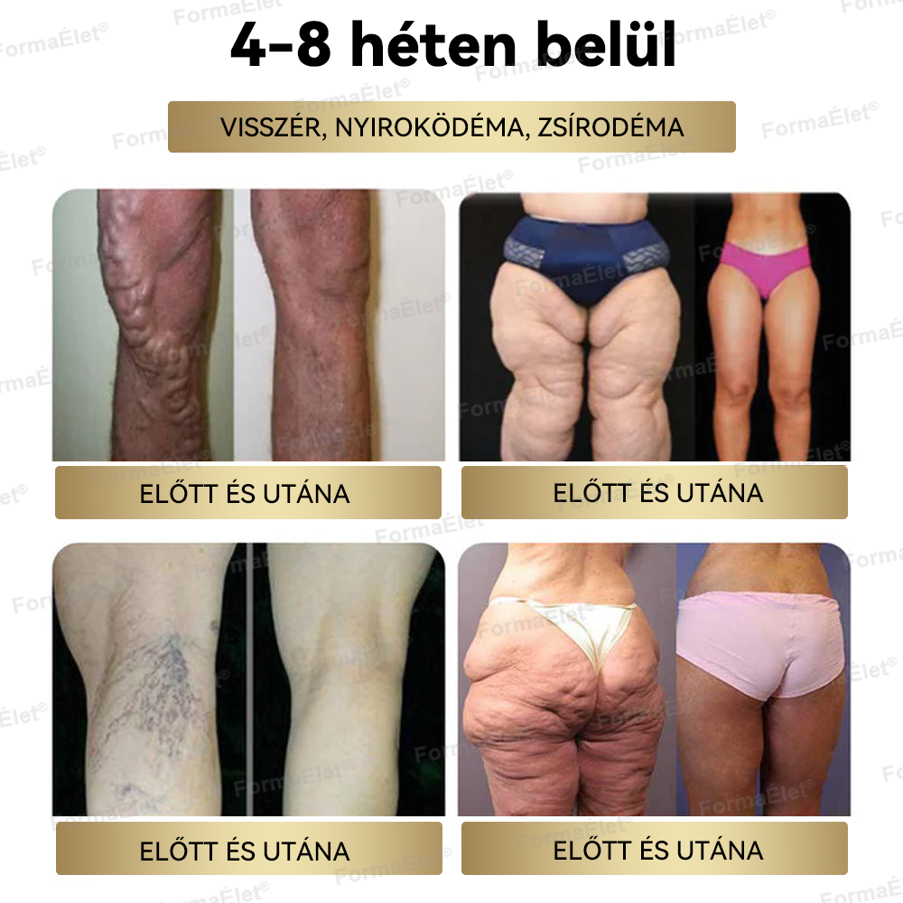 ❤️Hivatalos üzlet | FormaÉlet® GLP-1 Moringa Fogyókúrás és Egészségfokozó cseppek 🔥 (Élelmiszer-minőségű zsírégető – Az Obesity Society fejlesztése)