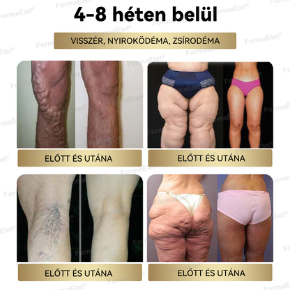 ❤️Hivatalos üzlet | FormaÉlet® GLP-1 Moringa Fogyókúrás és Egészségfokozó cseppek 🔥 (Élelmiszer-minőségű zsírégető – Az Obesity Society fejlesztése)