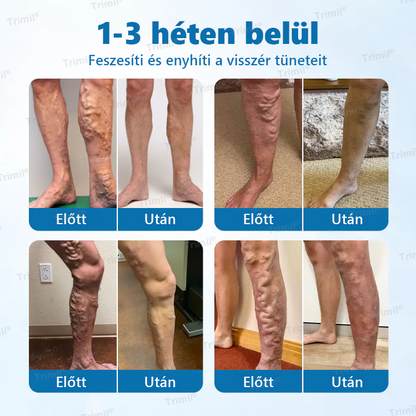 Trimil® VeinGuard Gyógynövényes Spray — ✨Klinikailag bizonyított, hogy mindössze 7 nap alatt megszünteti a visszereket!