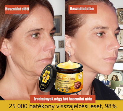 Bőrgyógyász ajánlása ✨ ZödVita® Méhméreg Bőr Helyreállító Krém 🍂 Magyar fejlesztés, magyarországi gyártás és szállítás