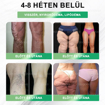 DOOEKA® GLP-1 8 az 1-ben Fit & Vital Szájon át szedhető oldat – Napi egyszer, 7 nap alatt látható változás / Elhízás, szív- és érrendszeri egészség, cukorbetegség, alvási apnoe, bélrendszer egészsége, ízületi problémák és még sok más esetén
