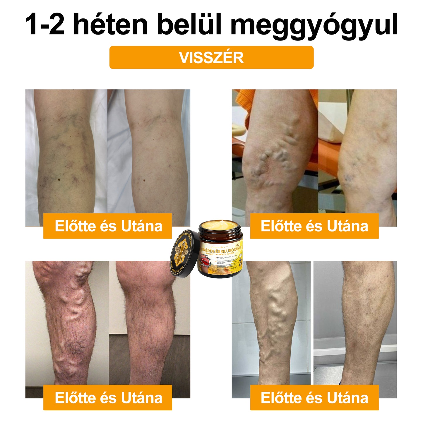 Gbpurity Méhméreg és Glükózamin Ízületi Krém – Hivatalos Márkabolt, MOT Jóváhagyással
