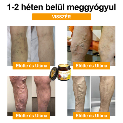 Gbpurity Méhméreg és Glükózamin Ízületi Krém – Hivatalos Márkabolt, MOT Jóváhagyással